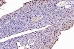 Immunohistochemistry (Paraffin-embedded Sections) (IHC (p)) image for anti-Nudix (Nucleoside Diphosphate Linked Moiety X)-Type Motif 22 (NUDT22) antibody (ABIN7074928)