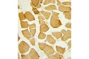 Formalin-fixed and paraffin-embedded human skeletal muscle reacted with EYA4 Antibody (C-term) followed which was peroxidase-conjugated to the secondary antibody, followed by DAB staining. (EYA4 抗体  (C-Term))