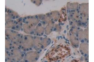 Immunohistochemistry (IHC) image for anti-Synuclein, gamma (Breast Cancer-Specific Protein 1) (SNCG) (AA 1-123) antibody (ABIN7429346)