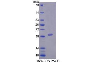 SDS-PAGE analysis of Human PCCa Protein. (PCCA 蛋白)