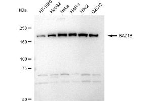 Western blotting analysis using BAZ1B antibody (ABIN7797797). (Recombinant BAZ1B 抗体)