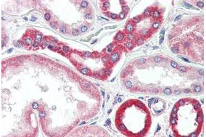 Human Kidney (formalin-fixed, paraffin-embedded) stained with BAK1 antibody ABIN461962 at 20 ug/ml followed by biotinylated goat anti-rabbit IgG secondary antibody ABIN481713, alkaline phosphatase-streptavidin and chromogen. (BAK1 抗体)