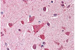 Human Brain, Cortex (formalin-fixed, paraffin-embedded) stained with TP53 antibody ABIN214388 at 2. (p53 抗体)