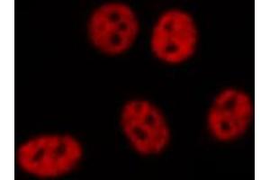 Immunofluorescence (fixed cells) (IF/ICC) image for anti-Zinc Finger, HIT-Type Containing 1 (ZNHIT1) (Internal Region) antibody (ABIN6266140)