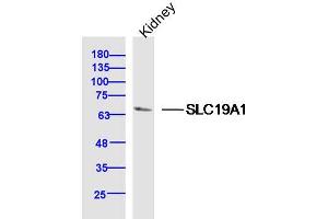Mouse Kidney lysates probed with SLC19A1 Polyclonal Antibody, Unconjugated  at 1:300 dilution and 4˚C overnight incubation. (SLC19A1 抗体  (AA 101-200))