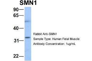 Western Blotting (WB) image for anti-Survival of Motor Neuron 1, Telomeric (SMN1) (N-Term) antibody (ABIN2778671)