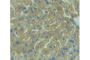 Used in DAB staining on fromalin fixed paraffin- embedded liver tissue (Reticulon 1 抗体  (AA 593-780))