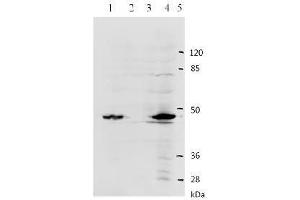 Western Blotting (WB) image for anti-Human Papilloma Virus Type 11 (HPV-11) (AA 83-201) antibody (ABIN781774) (人 Papilloma Virus Type 11 (HPV-11) (AA 83-201) 抗体)