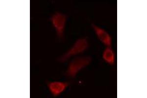 ABIN6274304 staining HepG2 cells by IF/ICC. (RED1 抗体  (Internal Region))