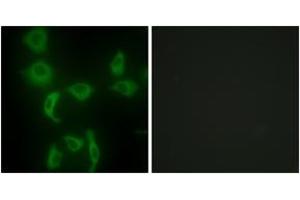Immunofluorescence analysis of HepG2 cells, using IARS2 Antibody. (IARS2 抗体  (AA 71-120))