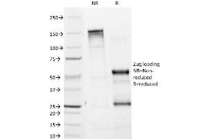 SDS-PAGE Analysis Purified Tyrosinase Monoclonal Antibody (T311). (TYR 抗体)