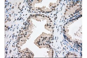 Immunohistochemistry (IHC) image for anti-Transforming, Acidic Coiled-Coil Containing Protein 3 (TACC3) antibody (ABIN1498097) (TACC3 抗体)