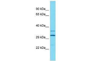 Host: Rabbit Target Name: ARL13A Sample Type: Fetal Liver lysates Antibody Dilution: 1. (ARL13A 抗体  (Middle Region))