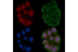 ABIN6266277 and ABIN6277434 staining Hela cells(45 min of heat-shock) by IF/ICC. (TCF7 抗体  (N-Term))