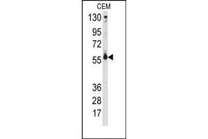 Image no. 1 for anti-Cytochrome P450, Family 2, Subfamily C, Polypeptide 9 (CYP2C9) (Middle Region) antibody (ABIN360247) (CYP2C9 抗体  (Middle Region))