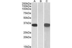 HEK293 lysate (10µg protein in RIPA buffer) overexpressing Human CRISP2 with C-terminal MYC tag probed with AP21265PU-N CRISP2 Antibody (1 µg/ml) in Lane A and probed with anti-MYC Tag (1/1000) in lane C. (CRISP2 抗体  (AA 81-93))