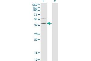 Western Blotting (WB) image for anti-SWI/SNF Related, Matrix Associated, Actin Dependent Regulator of Chromatin, Subfamily B, Member 1 (SMARCB1) (AA 123-202) antibody (ABIN520289)