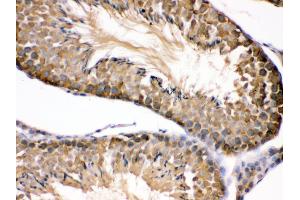 Immunohistochemistry (IHC) image for anti-Heat Shock Protein 90kDa alpha (Cytosolic), Class B Member 1 (HSP90AB1) (AA 449-481), (C-Term) antibody (ABIN3042462)