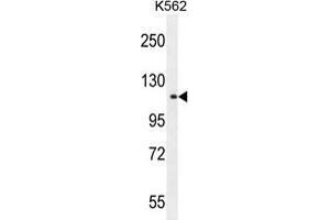 TDRD1 Antibody (C-term) western blot analysis in K562 cell line lysates (35 µg/lane). (TDRD1 抗体  (C-Term))