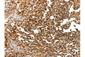 The image on the left is immunohistochemistry of paraffin-embedded Human tonsil tissue using ABIN7130100(LRP12 Antibody) at dilution 1/25, on the right is treated with fusion protein. (LRP12 抗体)