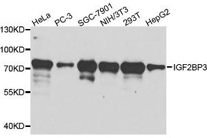 Western blot analysis of extracts of various cell lines, using IGF2BP3 antibody (ABIN5971465) at 1/1000 dilution. (IGF2BP3 抗体)