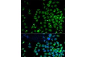 Immunofluorescence analysis of A-549 cells using UBD Polyclonal Antibody (UBD 抗体)