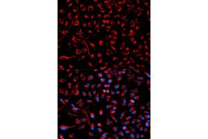 Immunofluorescence analysis of HeLa cells using DOK4 antibody (ABIN5970056). (DOK4 抗体)