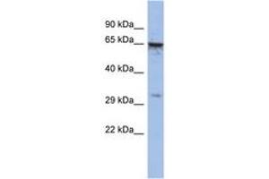 Image no. 1 for anti-Melanoma Antigen Family A, 9 (MAGEA9) (C-Term) antibody (ABIN6742783) (MAGEA9 抗体  (C-Term))