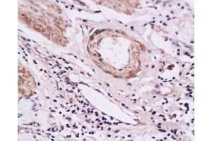 Immunohistochemistry (Paraffin-embedded Sections) (IHC (p)) image for anti-Selectin E (SELE) (AA 501-612) antibody (ABIN674244)