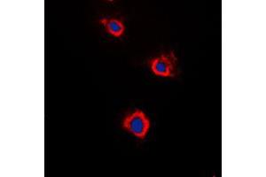 Immunofluorescent analysis of Adenylate Cyclase 5/6 staining in Raw264. (ADCY5/6 抗体  (C-Term))
