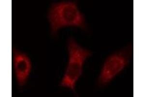 ABIN6277815 staining Hela cells by IF/ICC. (Caspase 4 抗体)