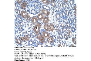 Rabbit Anti-ASS Antibody  Paraffin Embedded Tissue: Human Kidney Cellular Data: Epithelial cells of renal tubule Antibody Concentration: 4. (ASS1 抗体  (N-Term))