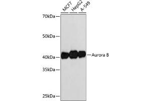 Western blot analysis of extracts of various cell lines, using Aurora B antibody (ABIN7265782) at 1:1000 dilution. (Aurora Kinase B 抗体)