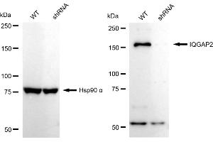 Western blotting analysis using IQGAP2 antibody (ABIN7799123). (Recombinant IQGAP2 抗体)
