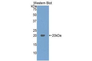 Western Blotting (WB) image for anti-Interferon, beta 1, Fibroblast (IFNB1) (AA 23-169) antibody (ABIN3209024) (IFNB1 抗体  (AA 23-169))