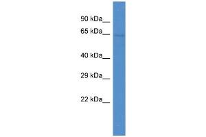 Host:  Rabbit  Target Name:  ZNF284  Sample Type:  OVCAR-3 Whole cell lysates  Antibody Dilution:  1. (ZNF284 抗体  (N-Term))