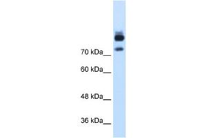 WB Suggested Anti-MTMR1 Antibody Titration:  1. (MTMR1 抗体  (C-Term))