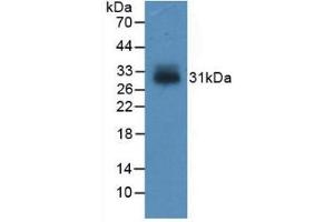 Western blot analysis of recombinant Human IGFBP4. (IGFBP4 抗体  (AA 22-258))