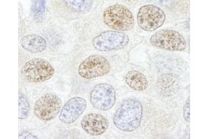 Immunohistochemistry (IHC) image for anti-DEAD (Asp-Glu-Ala-Asp) Box Polypeptide 46 (DDX46) (C-Term) antibody (ABIN7448521) (DDX46 抗体  (C-Term))