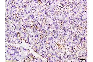 Formalin-fixed and paraffin embedded rat pancreas tissue labeled with Anti-CD105 Polyclonal Antibody, unconjugated(ABIN707561) at 1: 200 followed by incubation with conjugated secondary antibody and DAB staining (Endoglin 抗体  (AA 58-110))
