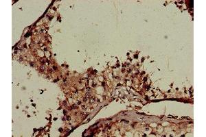 Immunohistochemistry of paraffin-embedded human testis tissue using ABIN7148445 at dilution of 1:100 (CNKSR2 抗体  (AA 650-800))