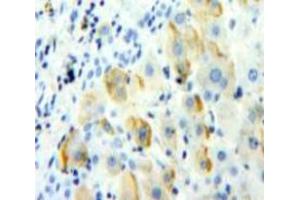 Used in DAB staining on fromalin fixed paraffin-embedded Liver tissue (TREM1 抗体  (AA 21-205))