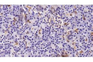 Immunohistochemistry (IHC) image for anti-Keratin 19 (KRT19) (AA 127-322) antibody (ABIN7426235)