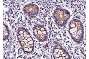 ABIN6268764 at 1/100 staining human colon tissue sections by IHC-P. (Claudin 5 抗体)