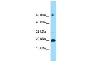 WB Suggested Anti-ADAT2 Antibody Titration: 1. (ADAT2 抗体  (C-Term))