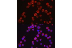 Immunofluorescence analysis of Jurkat cells using Tec Rabbit pAb (ABIN6128353, ABIN6148988, ABIN6148989 and ABIN6213654) at dilution of 1:50 (40x lens). (NR4A3 抗体  (AA 1-280))