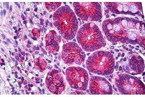 Human Small Intestine: Formalin-Fixed, Paraffin-Embedded (FFPE) (RHOH 抗体  (AA 141-190))