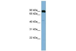 WB Suggested Anti-PSEN1 Antibody Titration:  0. (Presenilin 1 抗体  (N-Term))