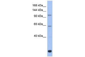WB Suggested Anti-BACH2 Antibody Titration: 0. (BACH2 抗体  (Middle Region))