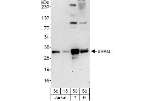 anti-Chromatin Target of PRMT1 (CHTOP) (AA 198-248) antibody